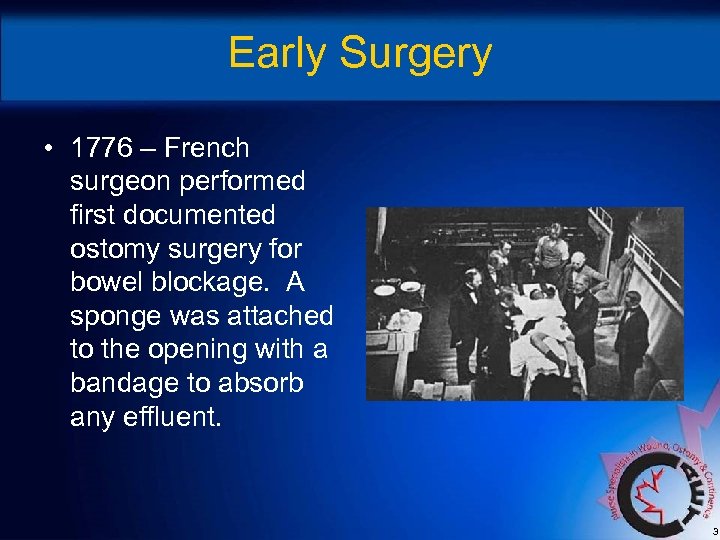 Early Surgery • 1776 – French surgeon performed first documented ostomy surgery for bowel