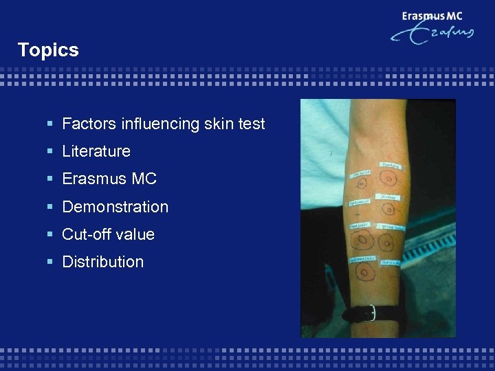 Topics § Factors influencing skin test § Literature § Erasmus MC § Demonstration §