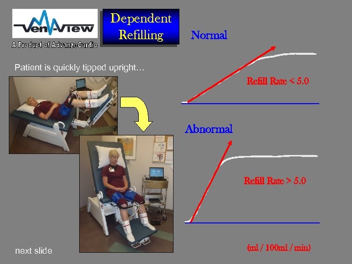 Dependent Refilling Normal Patient is quickly tipped upright… Refill Rate < 5. 0 Abnormal