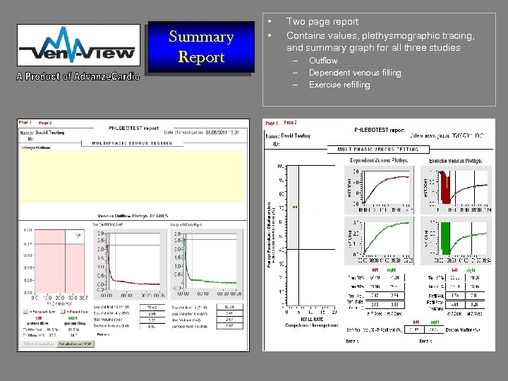 Summary Report • • Two page report Contains values, plethysmographic tracing, and summary graph