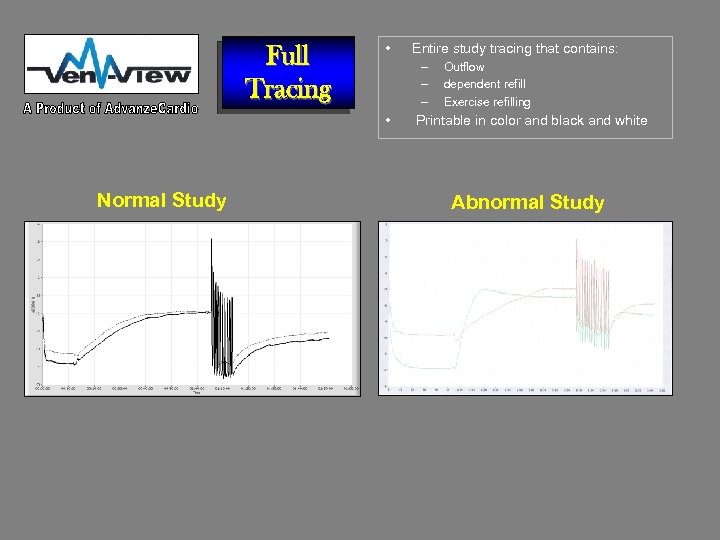 Full Tracing • – – – • Normal Study Entire study tracing that contains: