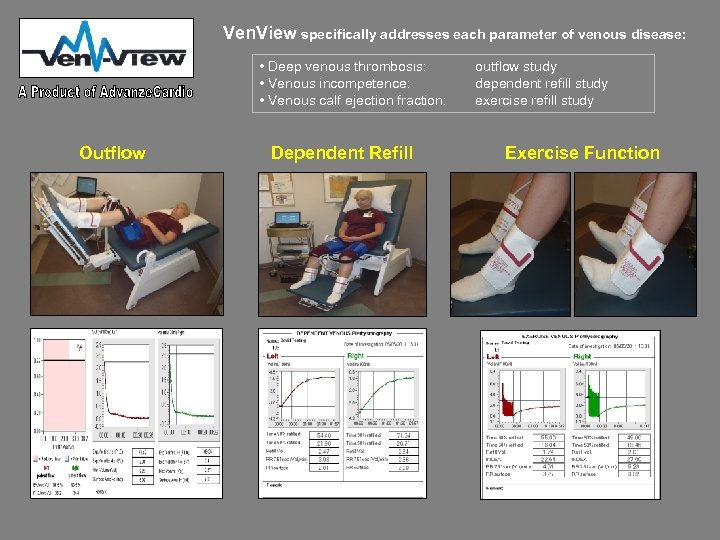 Ven. View specifically addresses each parameter of venous disease: • Deep venous thrombosis: •