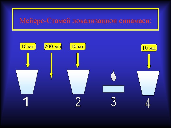 Мейерс-Стамей локализацион синамаси: 10 мл 200 мл 10 мл 