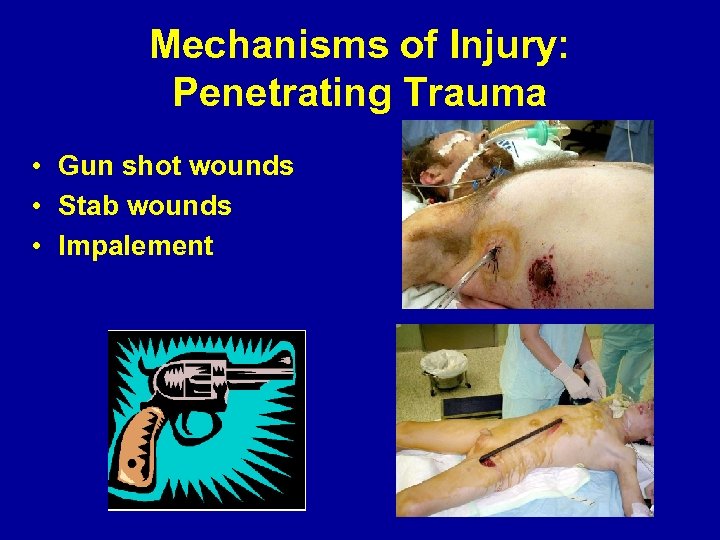 Mechanisms of Injury: Penetrating Trauma • Gun shot wounds • Stab wounds • Impalement