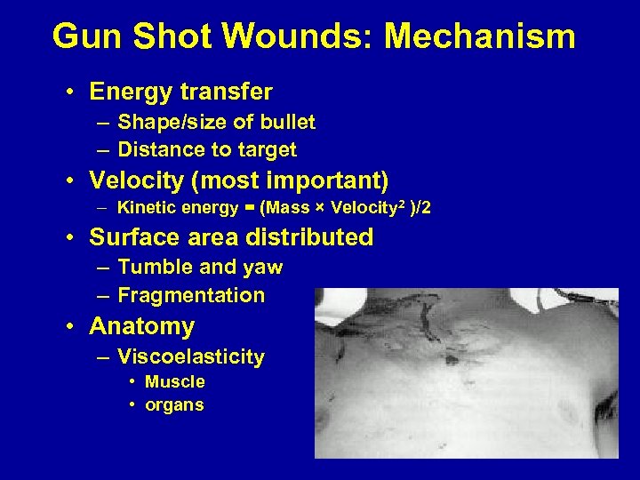 Gun Shot Wounds: Mechanism • Energy transfer – Shape/size of bullet – Distance to