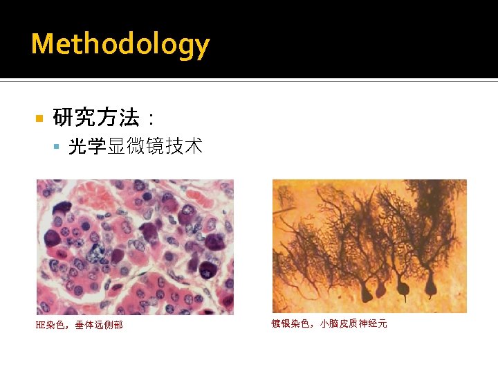 Methodology 研究方法： 光学显微镜技术 HE染色，垂体远侧部 镀银染色，小脑皮质神经元 