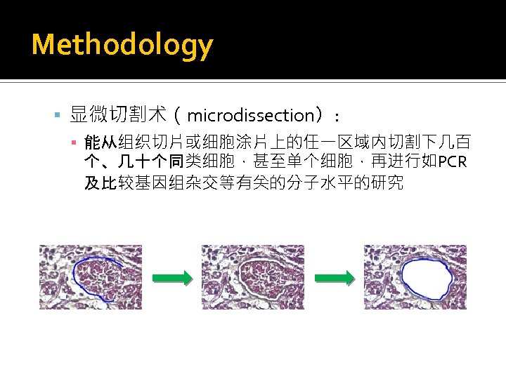 Methodology 显微切割术（microdissection）: ▪ 能从组织切片或细胞涂片上的任一区域内切割下几百 个、几十个同类细胞，甚至单个细胞，再进行如PCR 及比较基因组杂交等有关的分子水平的研究 