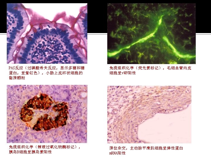 PAS反应（过碘酸希夫反应，显示多糖和糖 蛋白，呈紫红色），小肠上皮杯状细胞的 黏原颗粒 免疫组织化学（荧光素标记），毛细血管内皮 细胞呈v. WF阳性 免疫组织化学（辣根过氧化物酶标记）， 胰岛B细胞呈胰岛素阳性 原位杂交，主动脉平滑肌细胞呈弹性蛋白 m. RNA阳性 