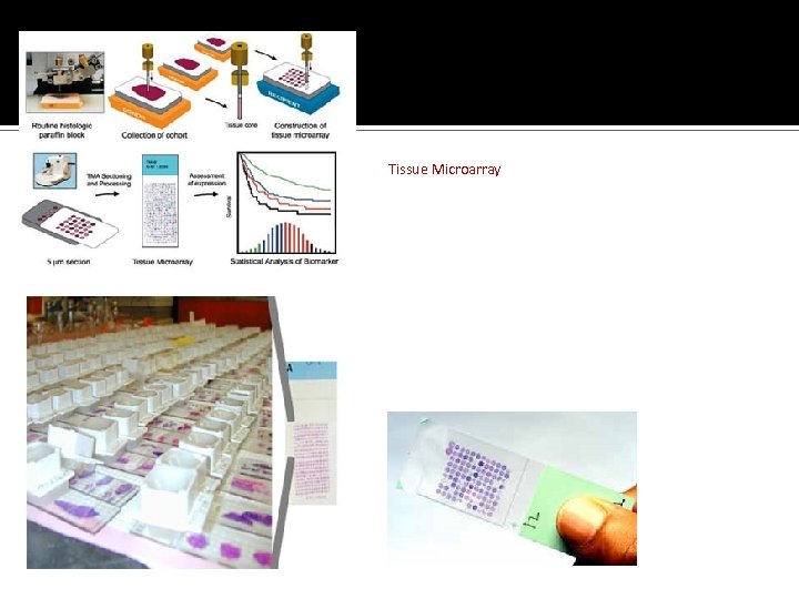 Tissue Microarray 