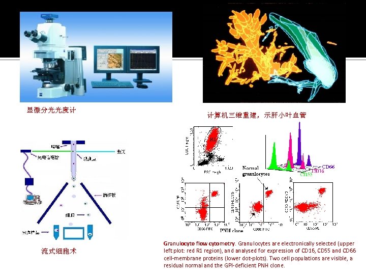 显微分光光度计 流式细胞术 计算机三维重建，示肝小叶血管 Granulocyte flow cytometry. Granulocytes are electronically selected (upper left plot: red