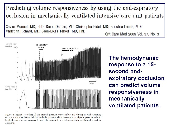 The hemodynamic response to a 15 second endexpiratory occlusion can predict volume responsiveness in