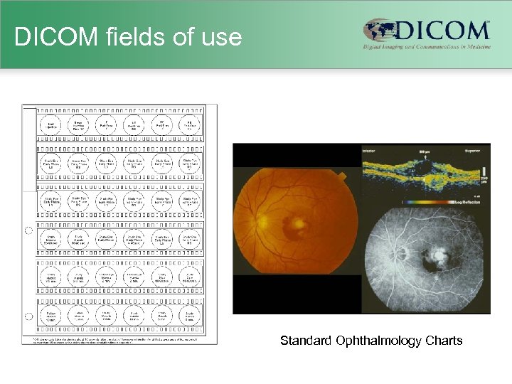 DICOM fields of use Standard Ophthalmology Charts 