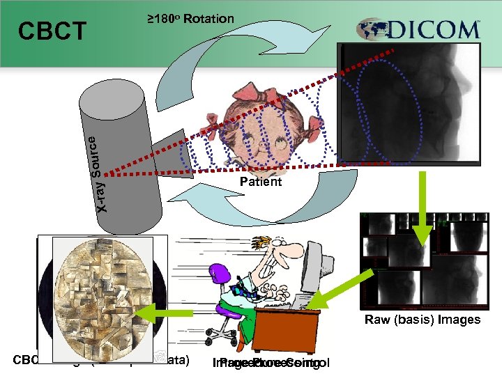 ≥ 180 o Rotation CBCT o X-ray S urce Solid State Detector Patient Raw