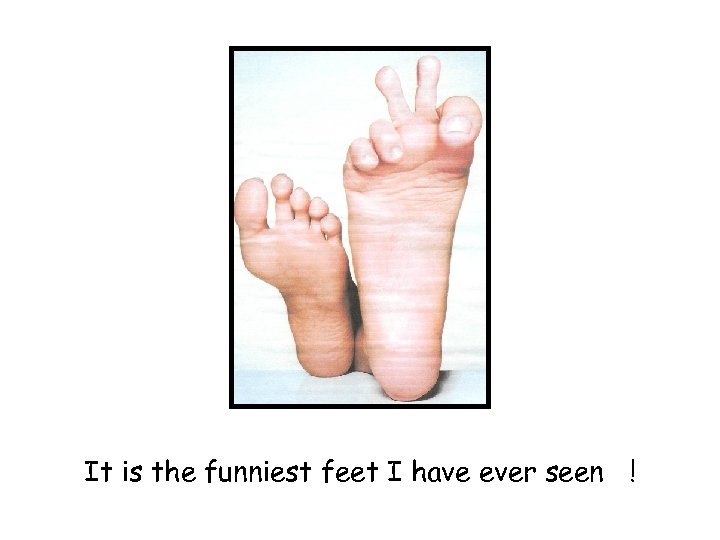 It is the funniest feet I have ever seen ! 