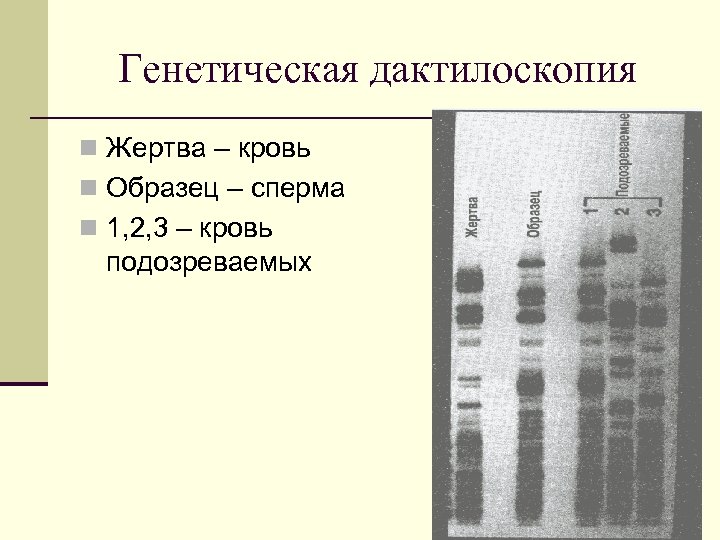 Генетическая дактилоскопия n Жертва – кровь n Образец – сперма n 1, 2, 3