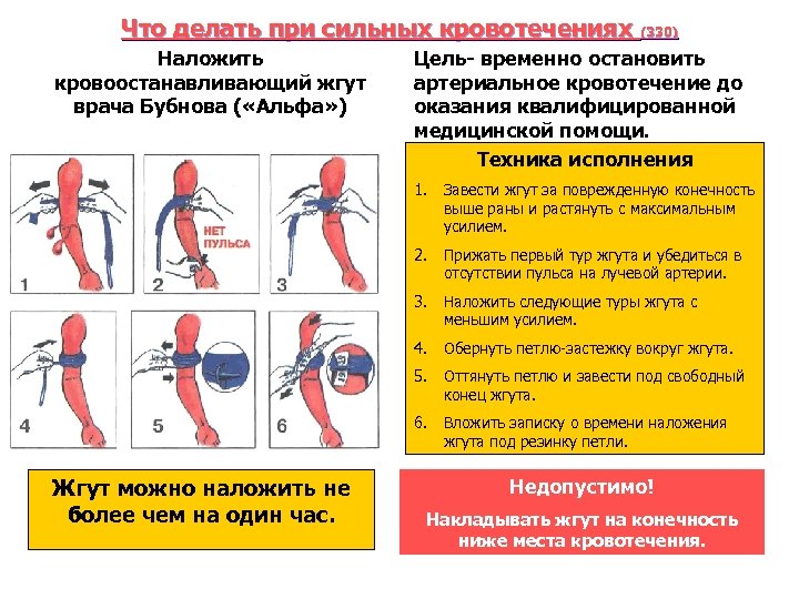Что делать при сильных кровотечениях (330) Наложить кровоостанавливающий жгут врача Бубнова ( «Альфа» )