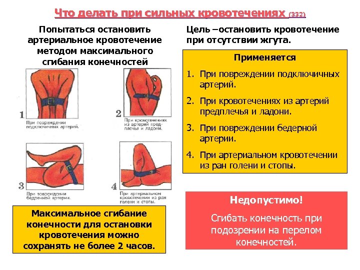 Что делать при сильных кровотечениях (332) Попытаться остановить артериальное кровотечение методом максимального сгибания конечностей