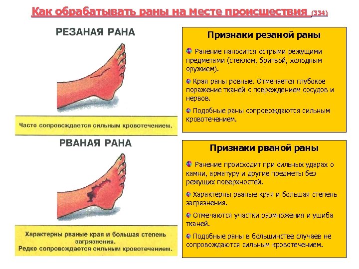 Как обрабатывать раны на месте происшествия (334). Признаки резаной раны Ранение наносится острыми режущими
