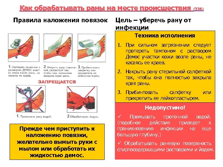 Как обрабатывать раны на месте происшествия (336) Правила наложения повязок Цель – уберечь рану