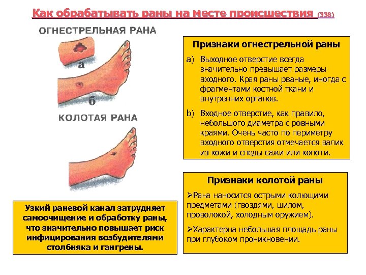 Как обрабатывать раны на месте происшествия (338) Признаки огнестрельной раны a) Выходное отверстие всегда