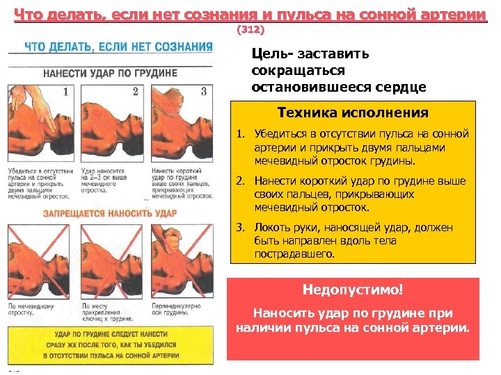 Что делать, если нет сознания и пульса на сонной артерии (312) Цель- заставить сокращаться