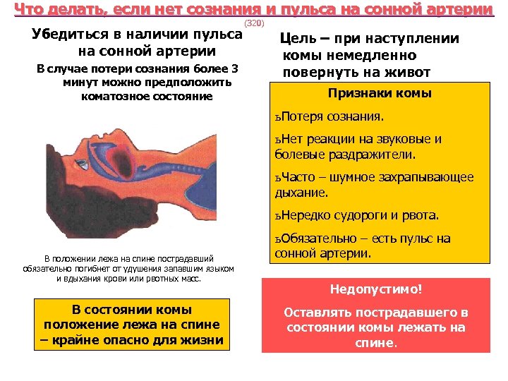 Что делать, если нет сознания и пульса на сонной артерии Убедиться в наличии пульса
