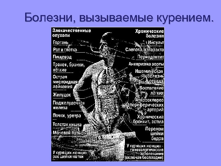 Болезни, вызываемые курением. 