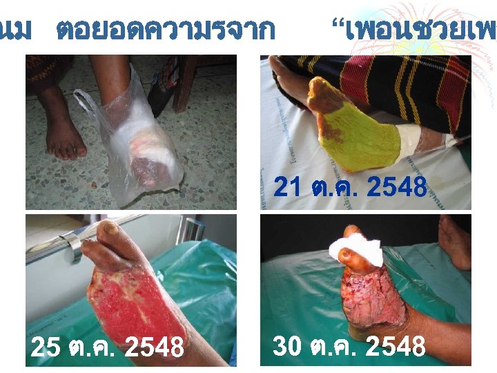 นม ตอยอดความรจาก “เพอนชวยเพอ 21 ต. ค. 2548 25 ต. ค. 2548 30 ต. ค.