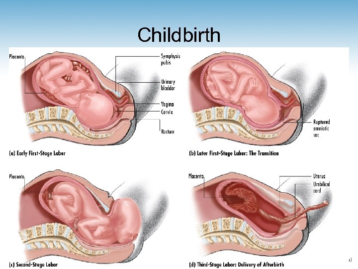 Childbirth 