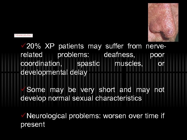 ü 20% XP patients may suffer from nerverelated problems: deafness, poor coordination, spastic muscles,