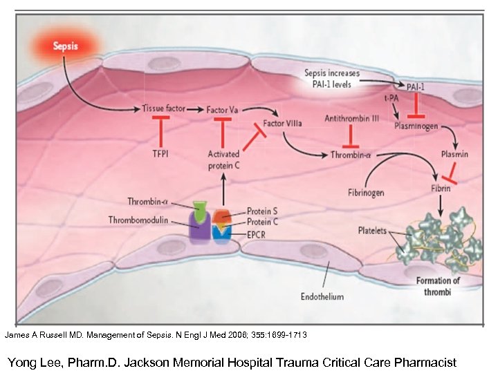 James A Russell MD. Management of Sepsis. N Engl J Med 2006; 355: 1699