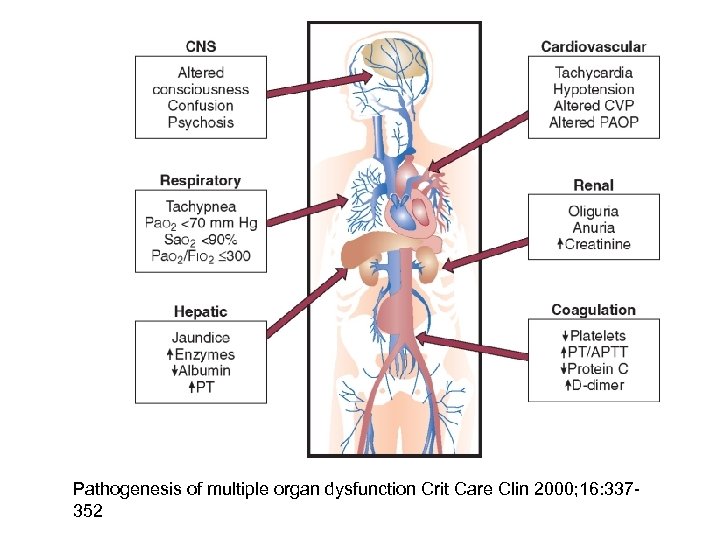 Pathogenesis of multiple organ dysfunction Crit Care Clin 2000; 16: 337352 