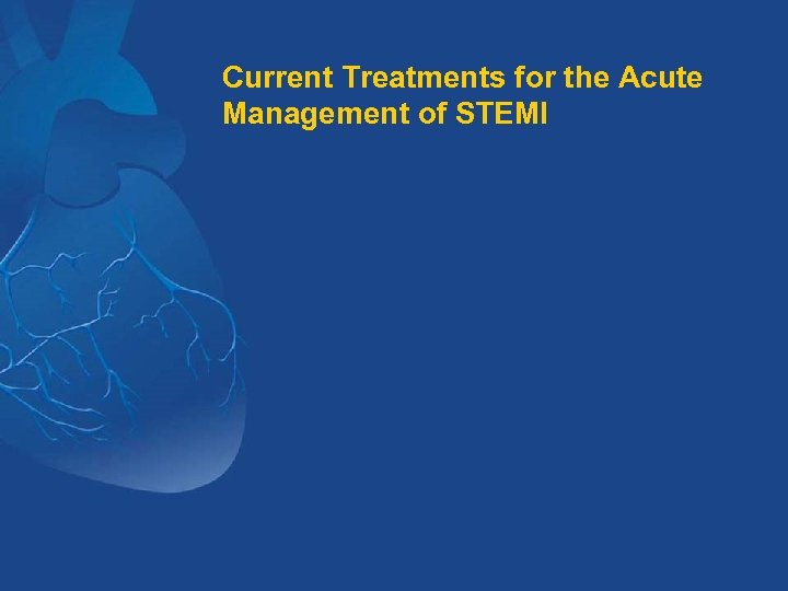 Current Treatments for the Acute Management of STEMI 