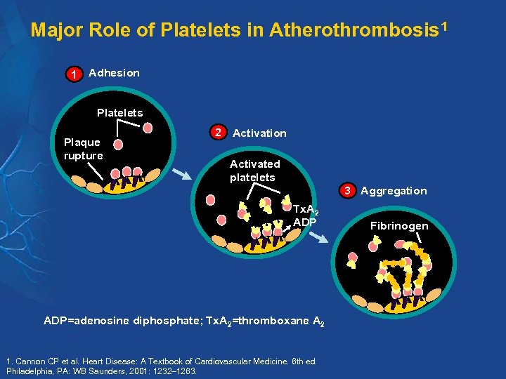 Major Role of Platelets in Atherothrombosis 1 1 Adhesion Platelets Plaque rupture 2 Activation