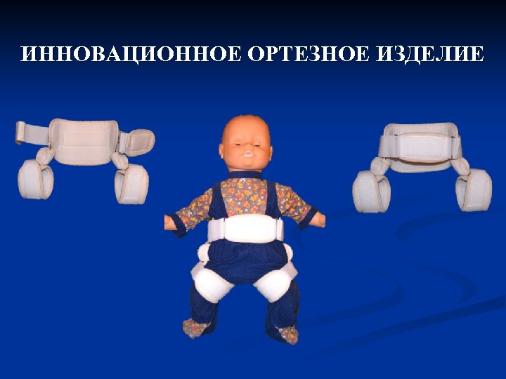 ИННОВАЦИОННОЕ ОРТЕЗНОЕ ИЗДЕЛИЕ 