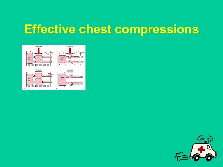 Effective chest compressions 12 
