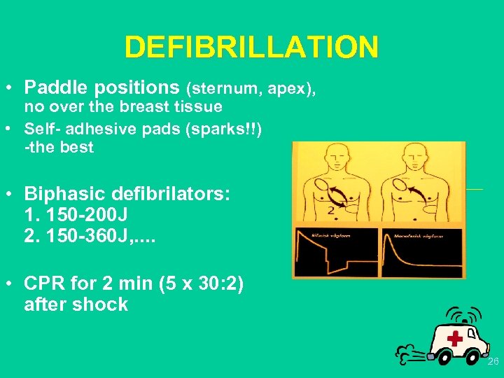 DEFIBRILLATION • Paddle positions (sternum, apex), no over the breast tissue • Self- adhesive