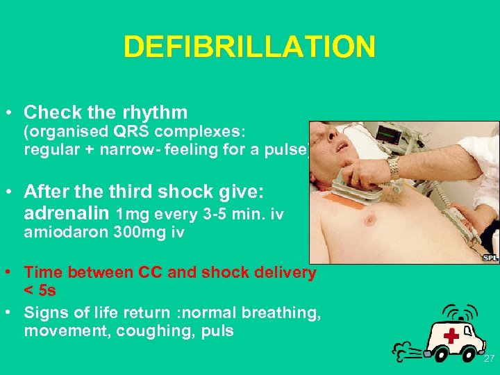 DEFIBRILLATION • Check the rhythm (organised QRS complexes: regular + narrow- feeling for a