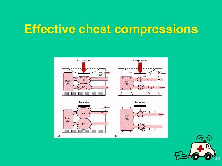 Effective chest compressions 48 