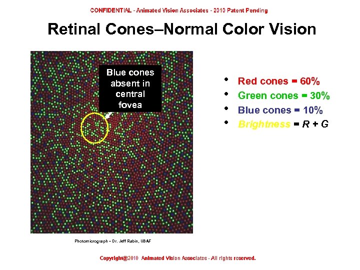 Retinal Cones–Normal Color Vision Blue cones absent in central fovea • • Red cones