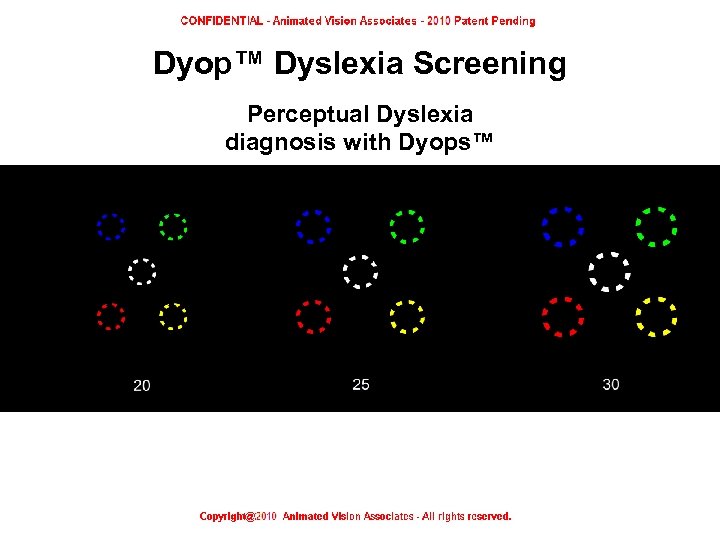 Dyop™ Dyslexia Screening Perceptual Dyslexia diagnosis with Dyops™ Dyop™ Dyslexia screening test 