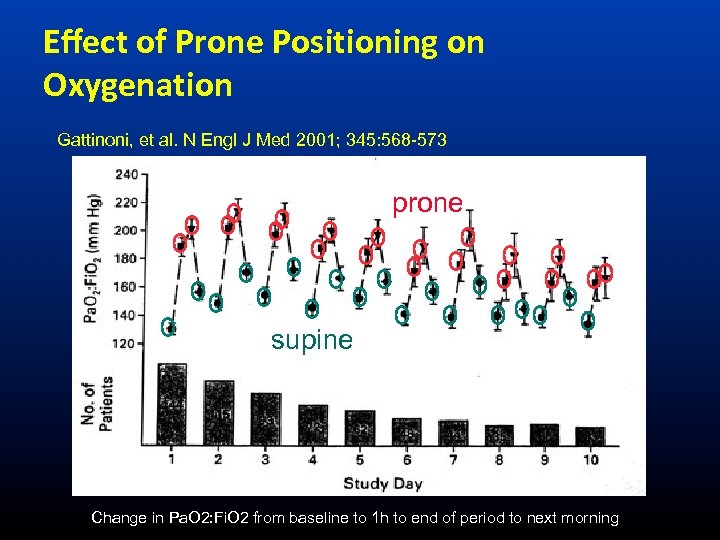 Eﬀect of Prone Positioning on Oxygenation Gattinoni, et al. N Engl J Med 2001;
