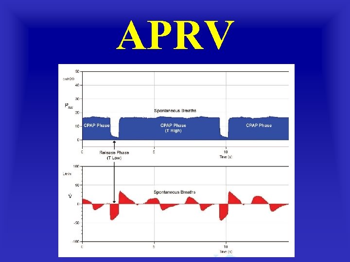 APRV 