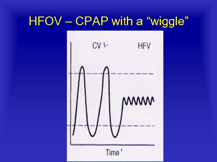 HFOV – CPAP with a “wiggle” 