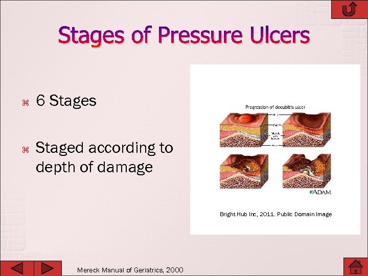 Stages of Pressure Ulcers 6 Stages Staged according to depth of damage Bright Hub