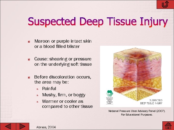 Suspected Deep Tissue Injury Maroon or purple intact skin or a blood filled blister