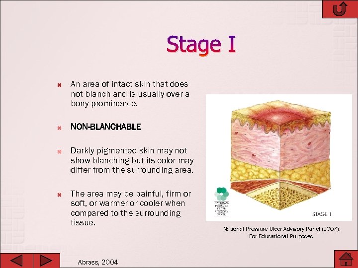 Stage I An area of intact skin that does not blanch and is usually