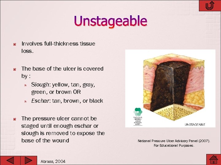 Unstageable Involves full-thickness tissue loss. The base of the ulcer is covered by :