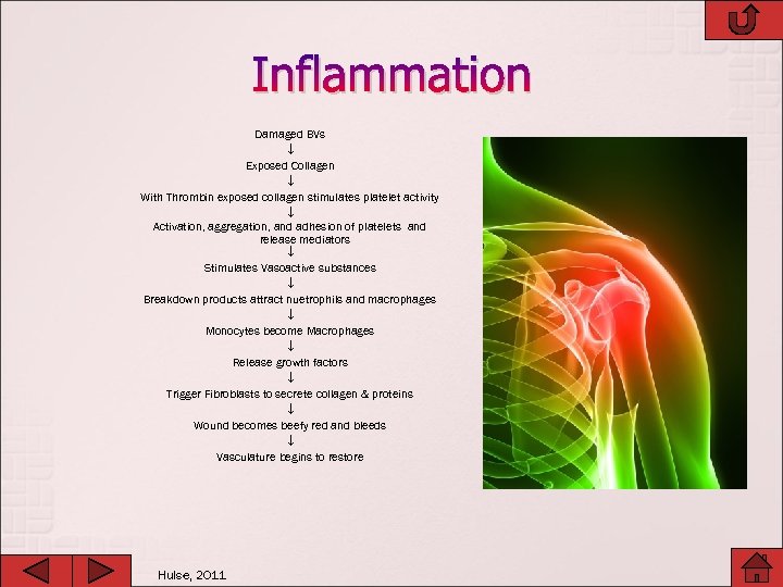 Inflammation Damaged BVs Exposed Collagen With Thrombin exposed collagen stimulates platelet activity Activation, aggregation,