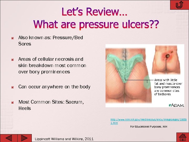 Let’s Review… What are pressure ulcers? ? Also known as: Pressure/Bed Sores Areas of